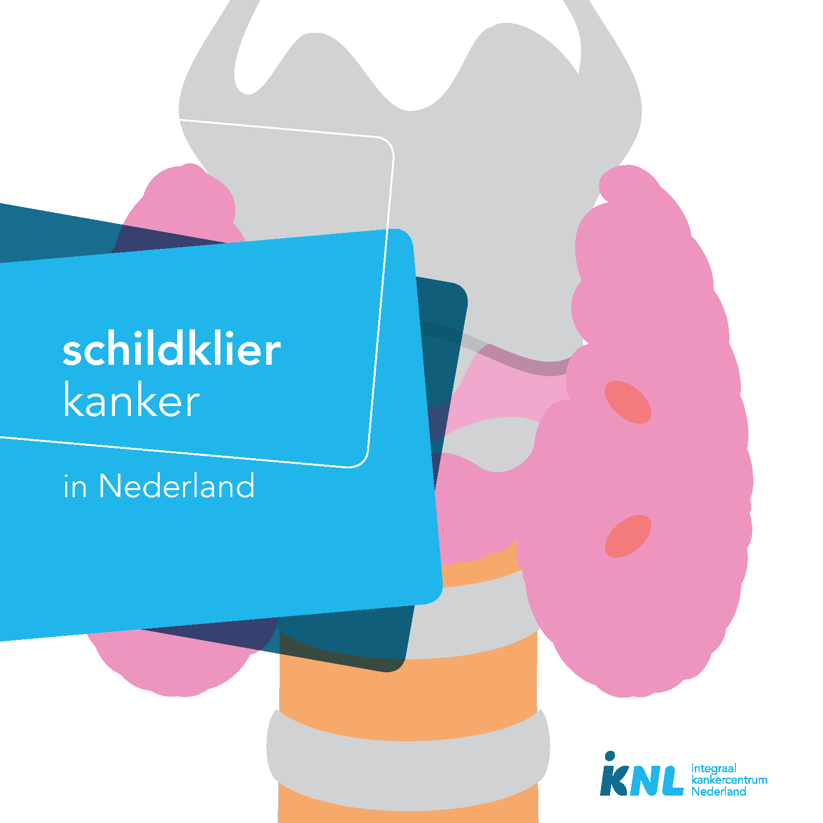 Schildklierkanker: cijfers uit de Nederlandse Kankerregistratie