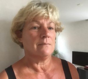 Mijn ervaring met de RFA-behandeling